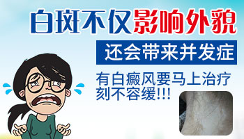 龟头白癜风影响性生活吗