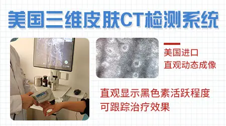 白癜风白斑部位出现轻微瘙痒是怎么回事