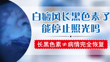 白癜风光疗能中间停止一段时间吗