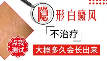 隐形白斑一定会显出来吗
