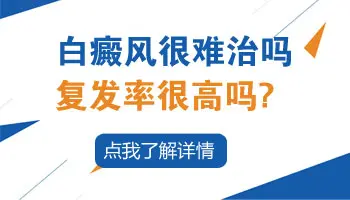白癜风复发时有什么表现 白斑复发图片