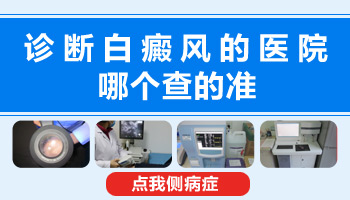 小孩脸部皮肤黑色素脱失会发展成白癜风吗