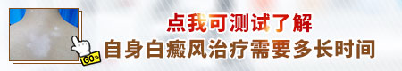 伍德氏灯和紫外线灯区别 哪个治疗白癜风