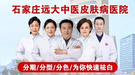 衡水治疗白癜风的医院哪个有名