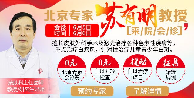 照伍德灯照出来是蓝白色白斑