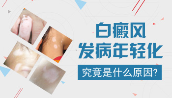 幼儿白斑的原因 预防白斑扩散的方法
