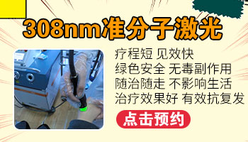 哪里可以买到治白斑的308仪器