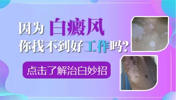 白癜风对入职体检有影响吗