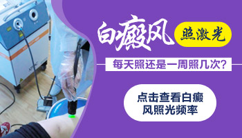 白癜风照308一个星期怎么没什么好转