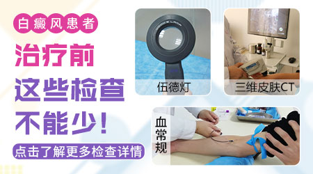常见白斑的症状图片 白斑有可能是什么