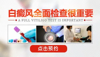 白癜风都有哪些类型 如何区分白斑类型