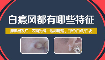 白癜风的症状有什么特点