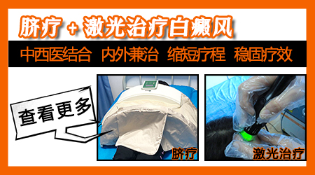 中医脐疗治白癜风费用是多少