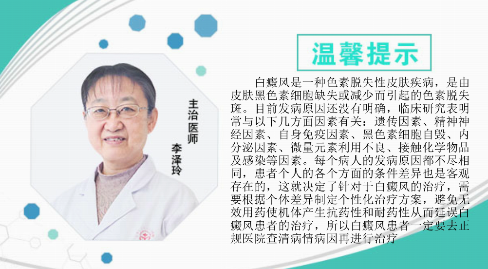 白癜风根本的原因是什么