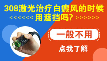 白癜风平时照光用什么遮住正常皮肤