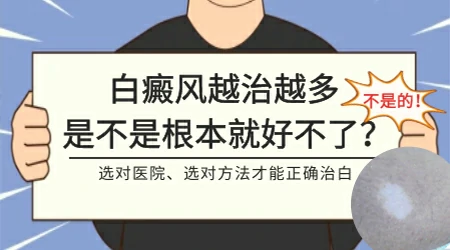 白癜风涂药膏照光都没用还有什么新的治疗方式