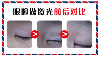 脸上和脖子部位胸前有好几块白斑是什么