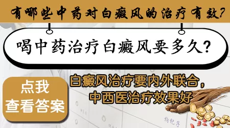 中药治白癜风 治白癜风的中药有哪些