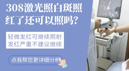 白癜风308激光后还有点红第三天用照吗