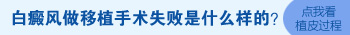 散发型白癜风手部植皮会不会复发
