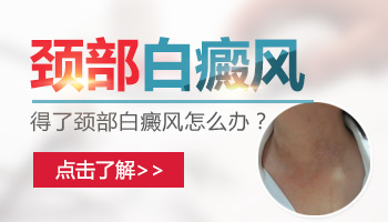 脖子上一块白一块白是怎么回事