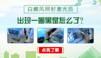 308准分子激光照白癜风照黑了怎么办