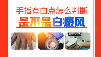 女性手指关节处发白图片