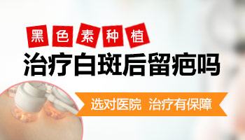 白癜风黑色素培植提取时候会有伤口吗