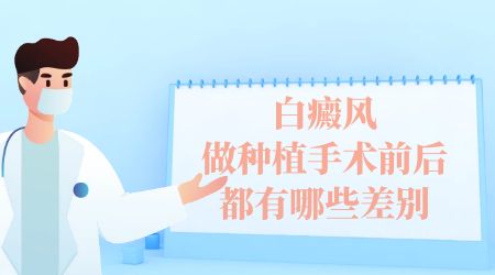 黑色素种植治疗白癜风需要注意什么?