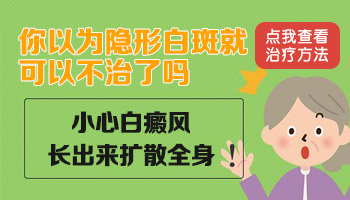 伍德灯能看到隐形白癜风吗