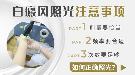 白癜风早期照308激光间隔多久照一次好