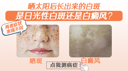 长白癜风跟晒太阳有没有关系