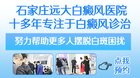 宝宝身上长白斑不一定是白癜风