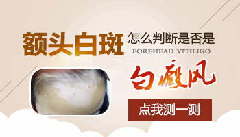 三个月宝宝额头突然一片白