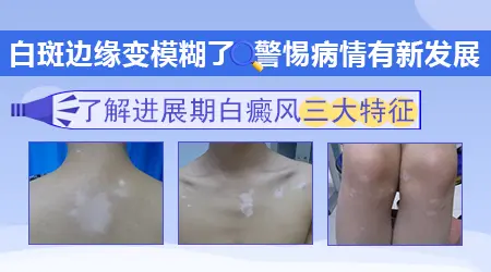 美国308激光和国产308光对比