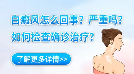 伍德灯检查显示色素脱失是否意味着病情严重