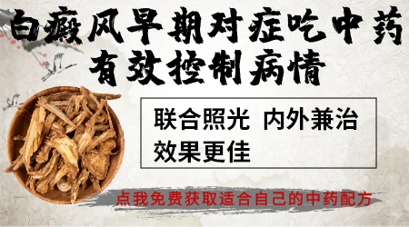 早期白癜风中药治疗需要多长时间