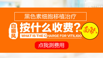 白癜风细胞移植手术要多少钱
