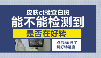 白癜风出现黑点是恢复了吗 白癜风恢复图片