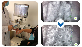 嘴角皮肤明显白于其他地方的皮肤怎么回事