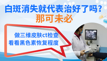 白癜风一小块吃了半个月中药好了