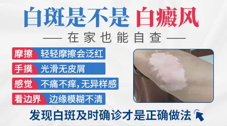 皮肤上突然冒出一块比周围浅的白斑是白癜风吗