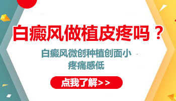 白癜风细胞移植过程受罪吗
