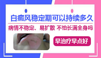 白癜风怎样算静止期