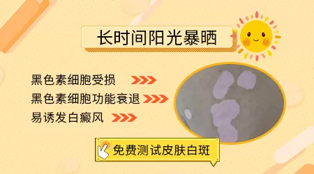 阳光暴晒会诱发白癜风吗
