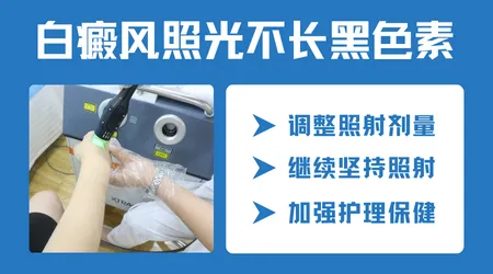 白癜风照308激光几次会出黑色素