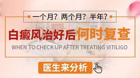 白癜风定期复查要检查哪些项目