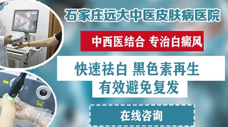 石家庄专治皮肤白斑的医院
