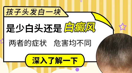 孩子额头白斑白发怎么回事