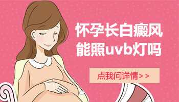 uvb灯对孕妇白癜风患者有影响吗